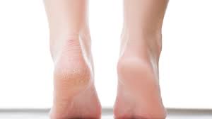 Medi-Peel on Feet (Add-on Treatment)